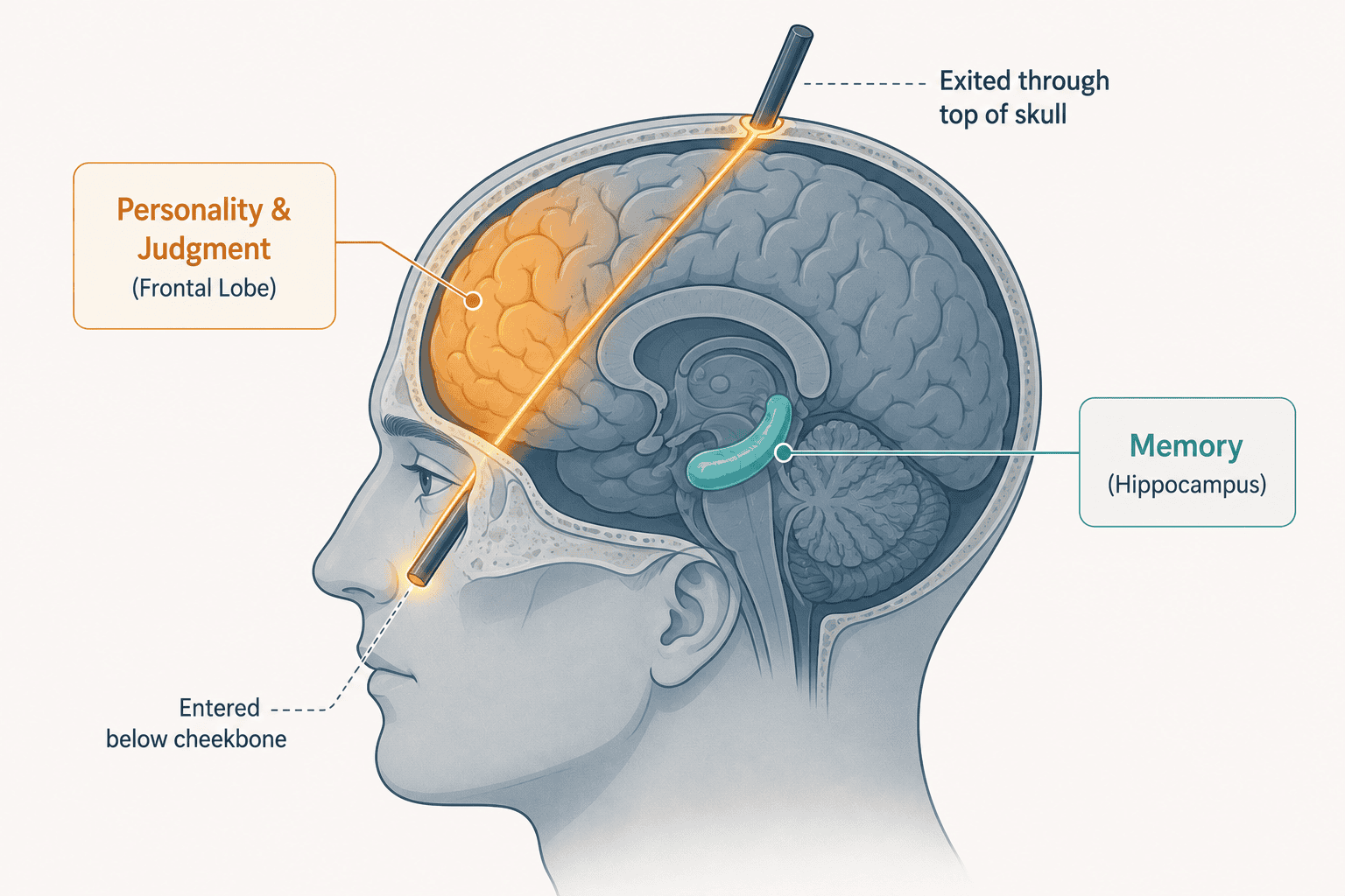 neuropsychology - brain injury disorders